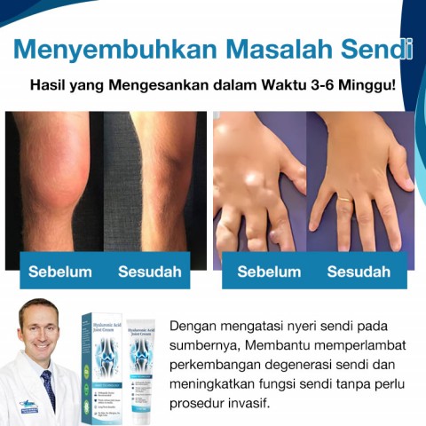 Krim Perbaikan Sendi Asam Hialuronat