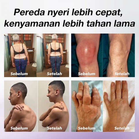 Kresin Gel Nyeri Sendi Gel Ungu
