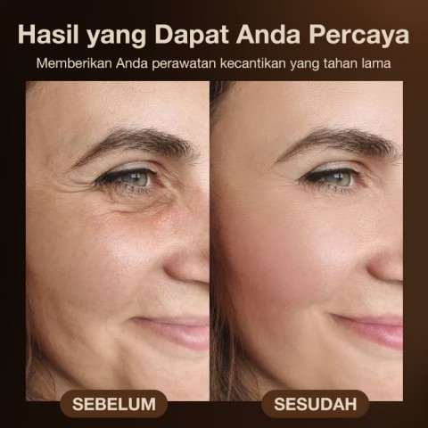 Alat Kecantikan Pengangkat Wajah Peremajaan Kulit Multifungsi