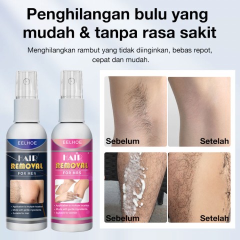 Losion penghilang bulu badan