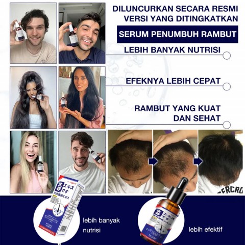 Serum penumbuh rambut