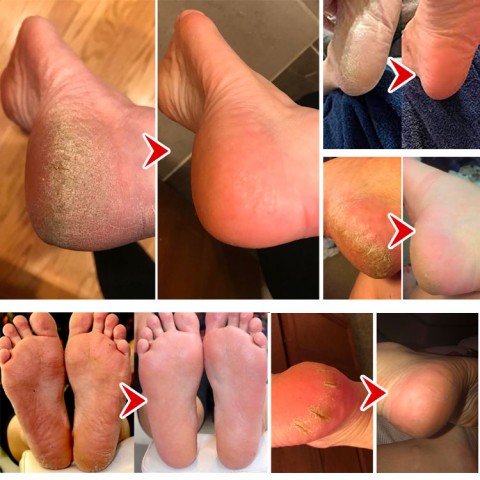 Baru USB Electric Foot Grinder Kulit Pecah Keras Kulit Pemangkas Kulit Mati Kaki Lembut dan Indah