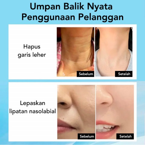 Alat kecantikan pijat yang mengangkat & mengencangkan kulit